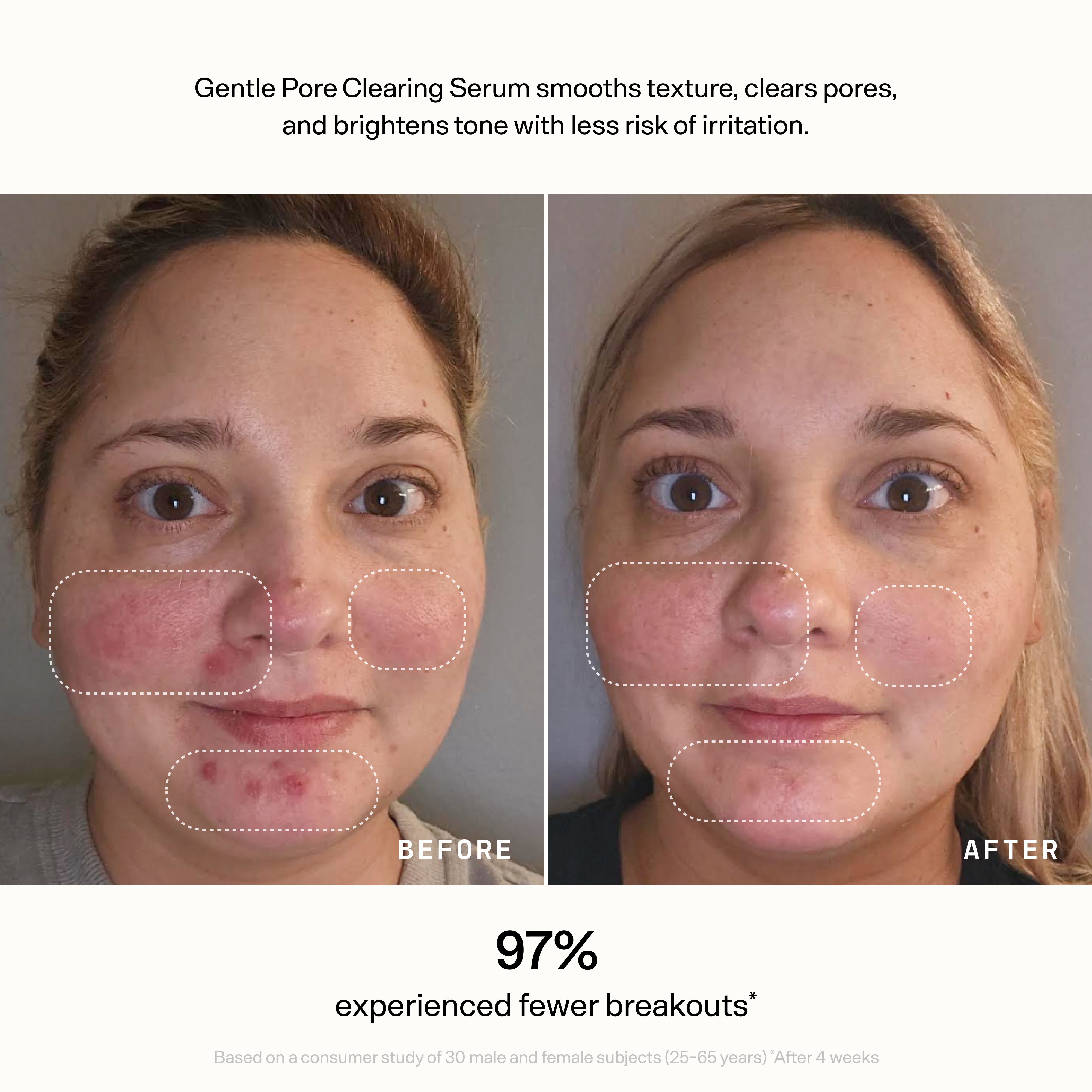 Skin Refine